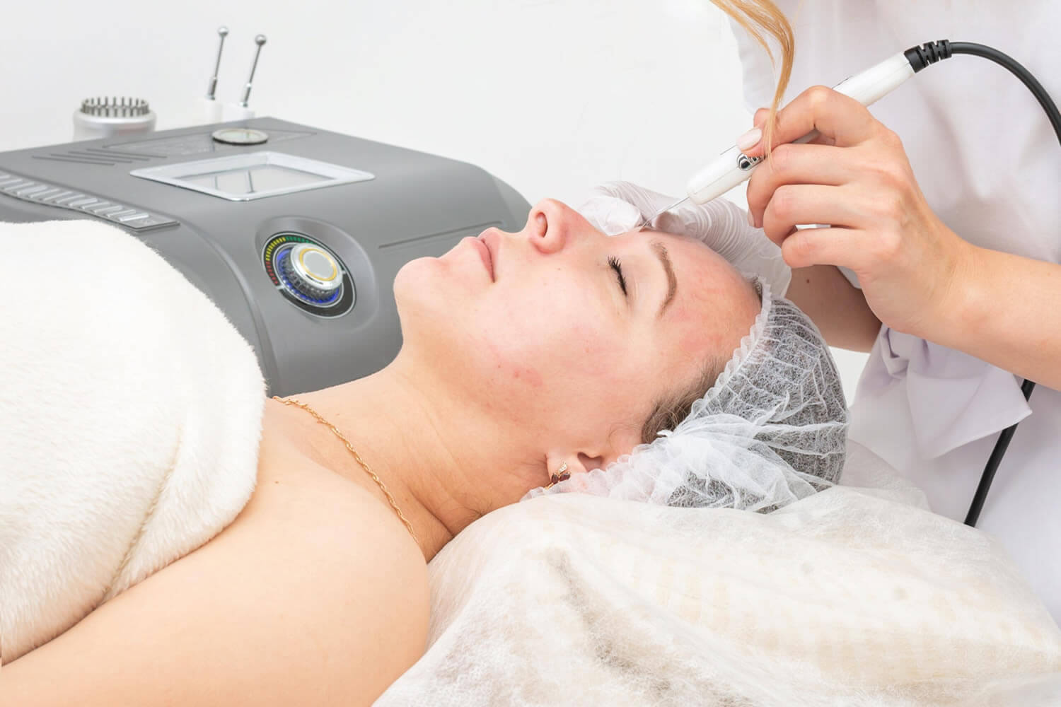 Microdermabrasion Galerie (4)